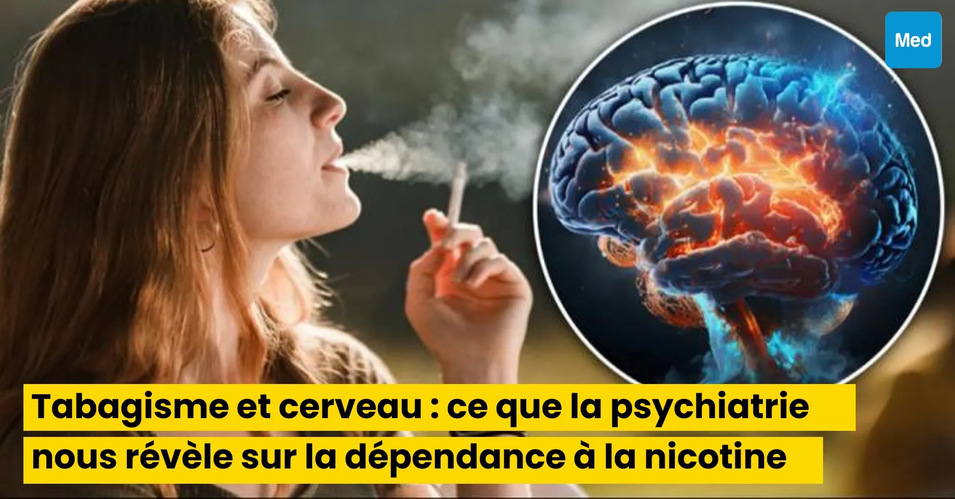 Tabagisme et cerveau : ce que la psychiatrie nous révèle sur la dépendance à la nicotine